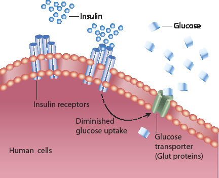 Scientists discover new causes of diabetes